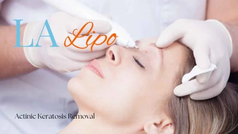 Woman receiving Actinic Keratosis Removal Treatment Sandbach