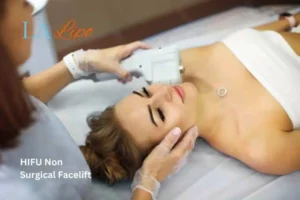 Woman having Hi-Fu to reduce wrinkles Sandbach.