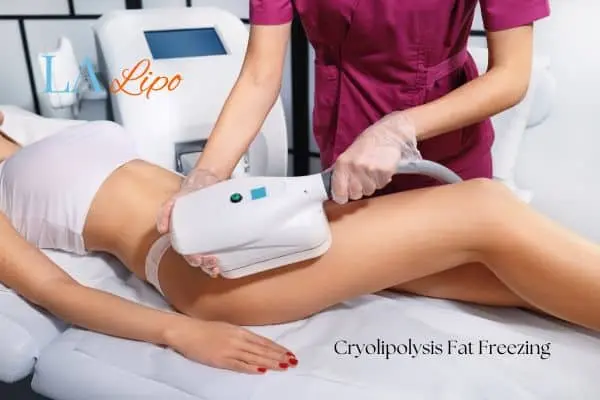 Woman receiving coolsculpting Sandbach treatment on her thighs