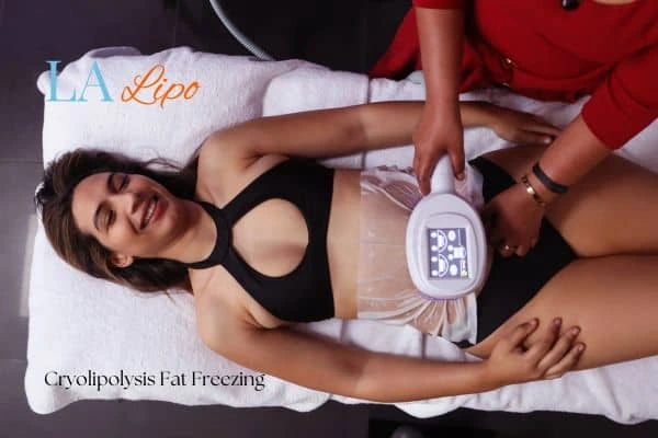 woman getting cryolipolysis Sandbach