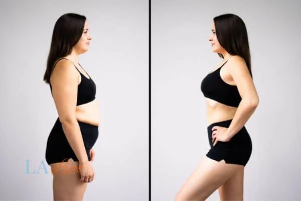link between body image and mental health Sandbach