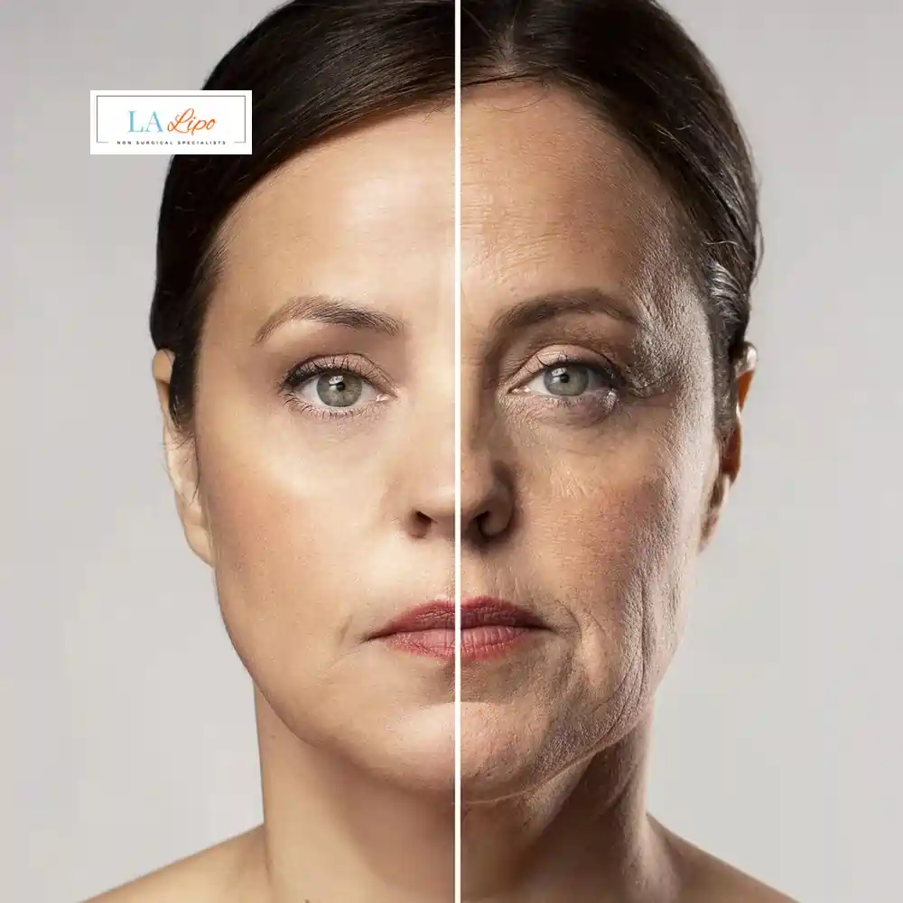 How Can You Tell If Non-Surgical Skin Tightening Is Right for You Sandbach?