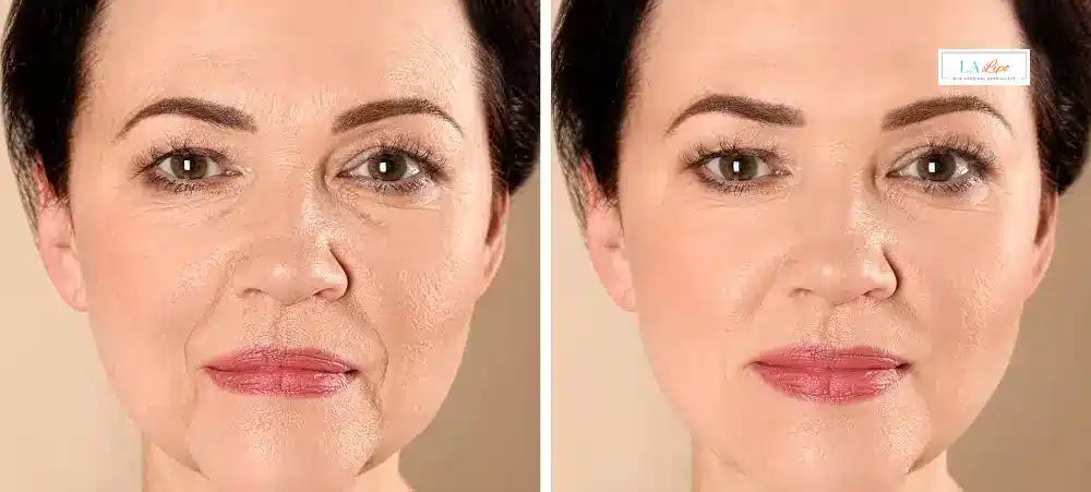 How Long Does It Take to See Results and How Long Do They Last Sandbach?