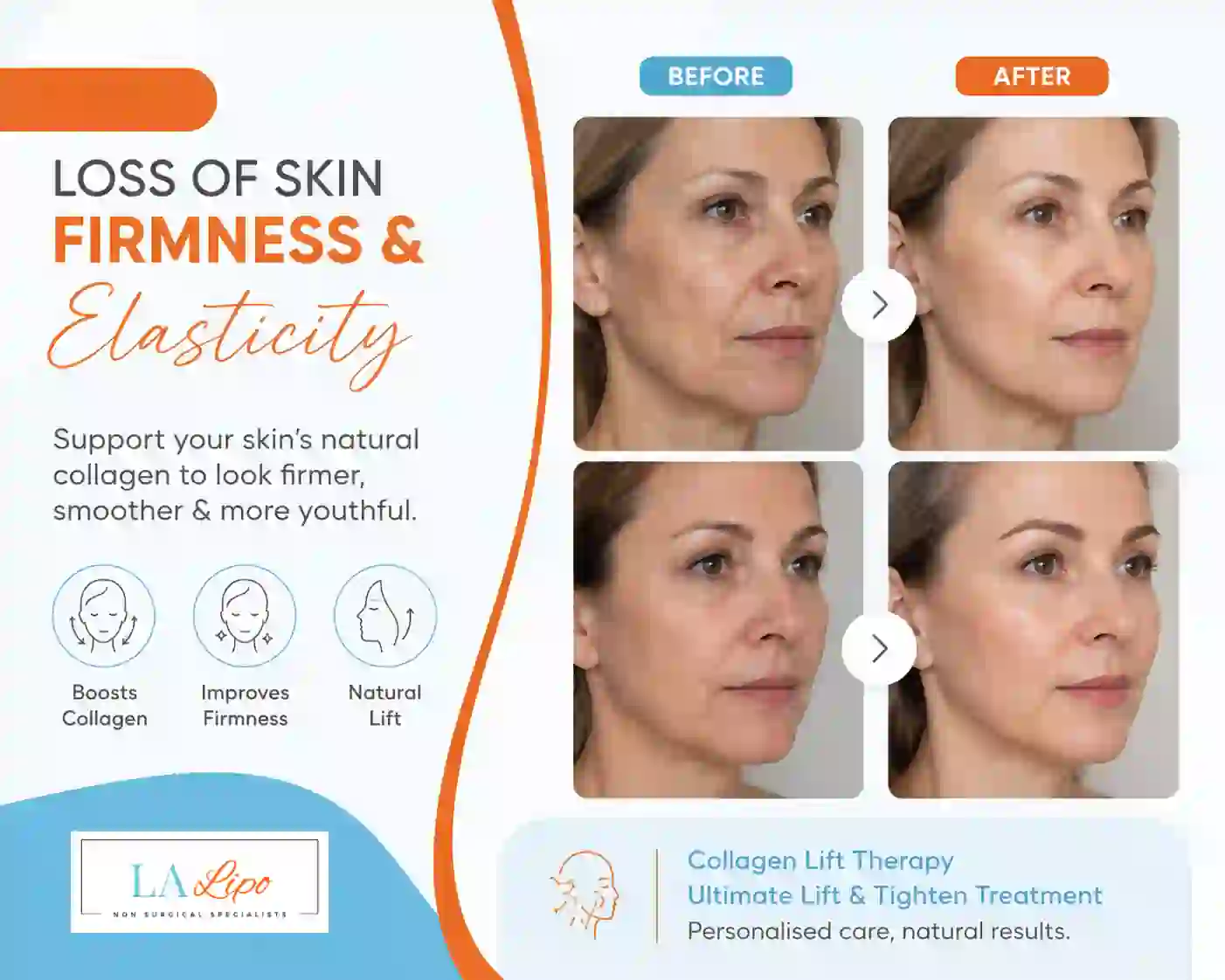 Sign #7: Loss of Skin Firmness and Elasticity Sandbach
